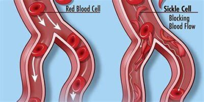 Graphic of blood vessels