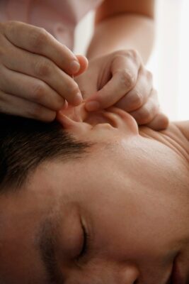 Person receiving acupuncture